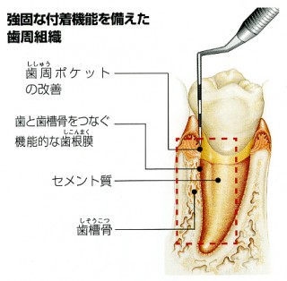 エムドゲインゲルを使った治療方法